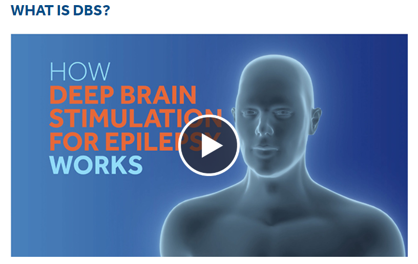 Deep Brain Stimulation